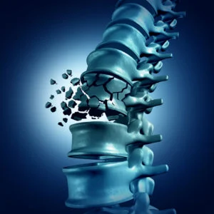 According to the American Chiropractic Image